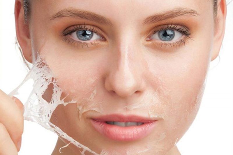 Dermal Fillers at MediSkin Aesthetics Serving Chevening