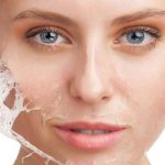 Dermal Fillers near Biggin Hill Greater London (London)