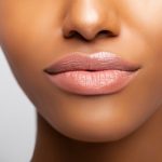 Dermal Fillers near Bletchingley Surrey