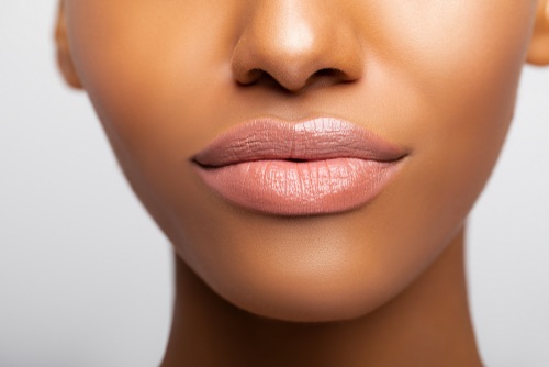 Body treatments Fotona Laser treatments skin treatments Surg Dermal Fillers near Bletchingley Surrey