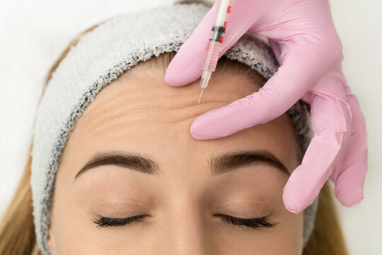 Body treatments Fotona Laser treatments skin treatments Surg Dermal Fillers near Blindley Heath Surrey