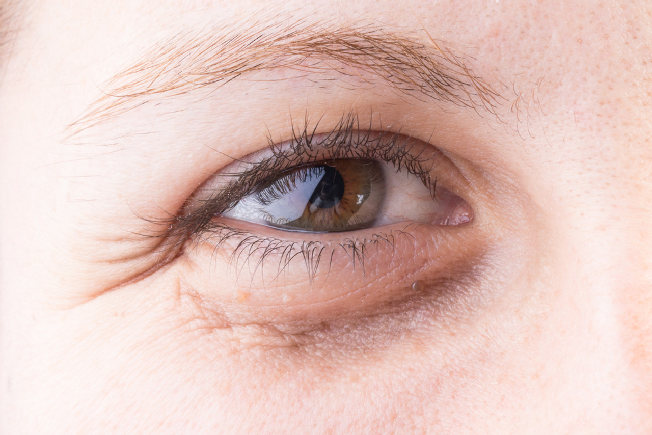 Body treatments Fotona Laser treatments skin treatments Surg Dermal Fillers near Brasted Kent